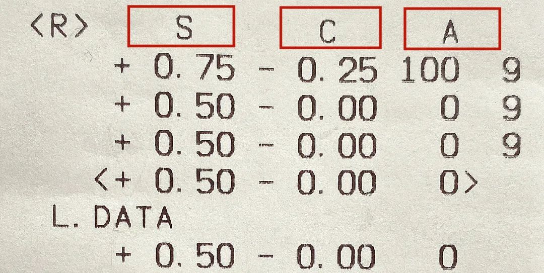 s代表球鏡,表示 近視或遠視度數(