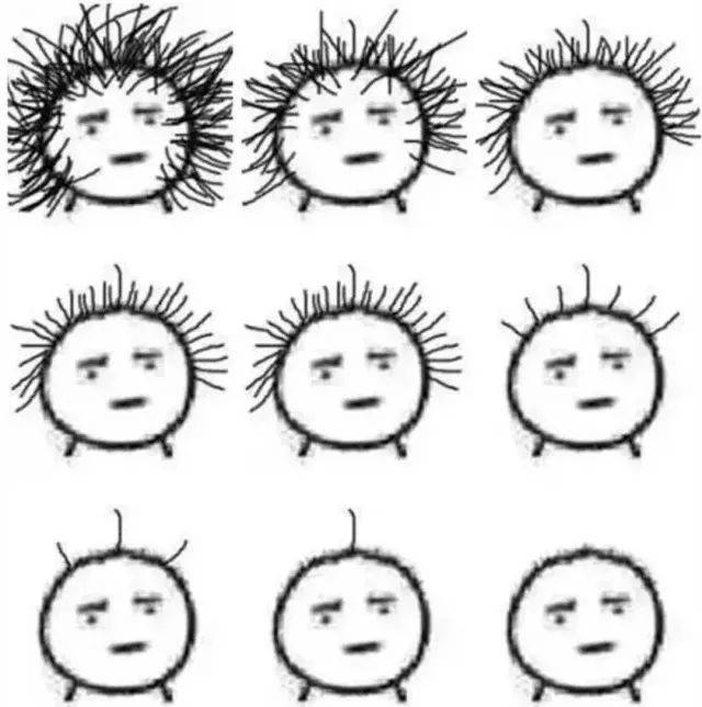 脱发那些事,你真的了解吗?