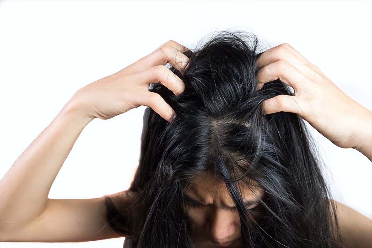 头发痒是怎么回事怎么解决（洗了头还总是头痒、头皮屑多？4个原因被你忽视了） | 说明书网