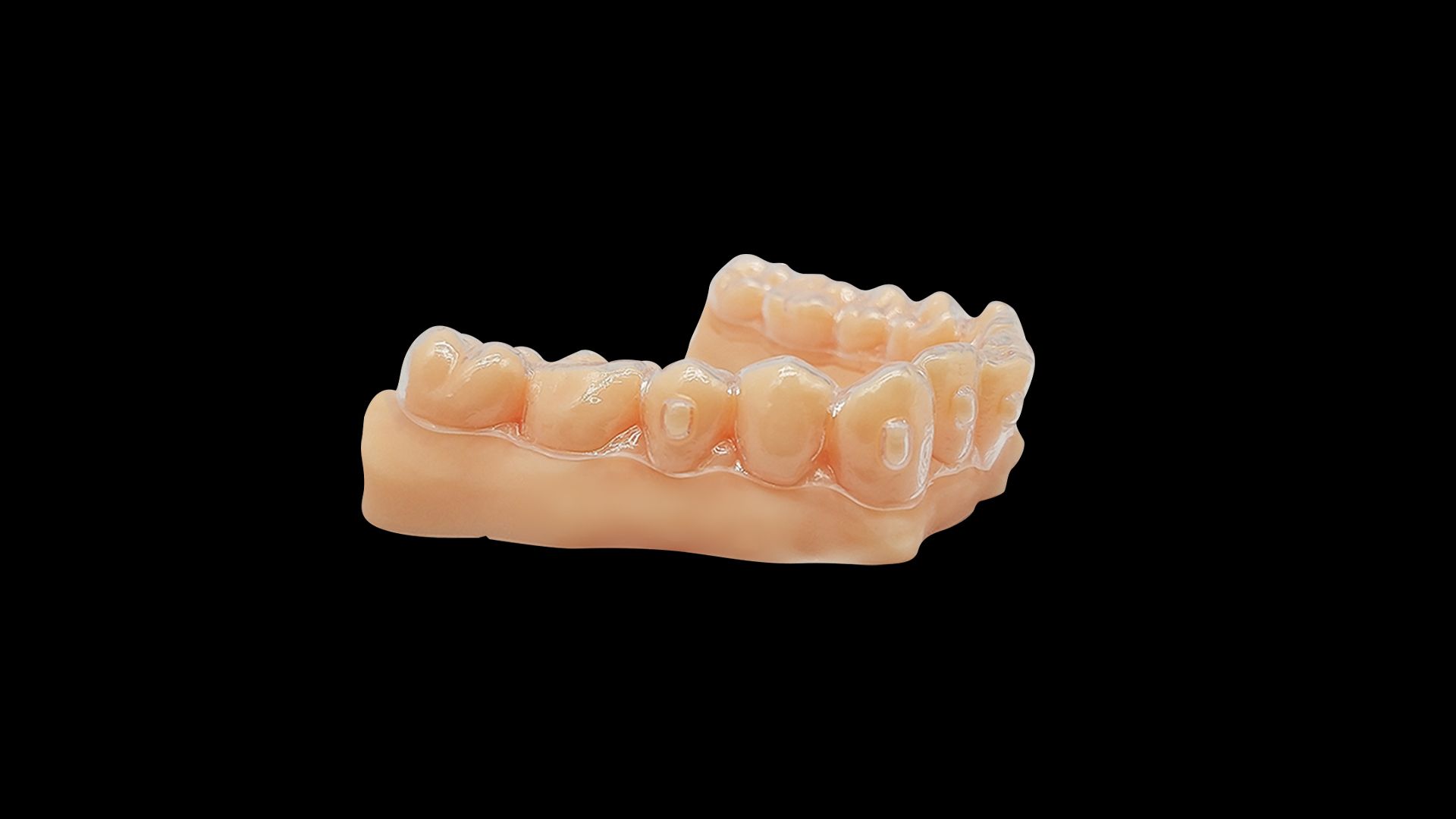 每天3D打印15万套口腔正畸牙模--松江报