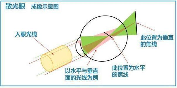 散光成像示意图