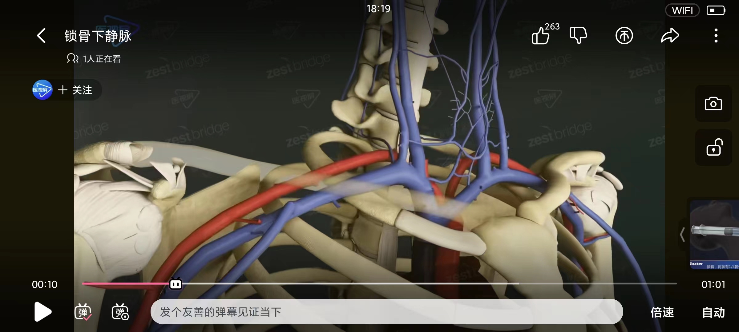 锁骨下静脉(感觉靠腋窝)穿刺知识点 - 哔哩哔哩