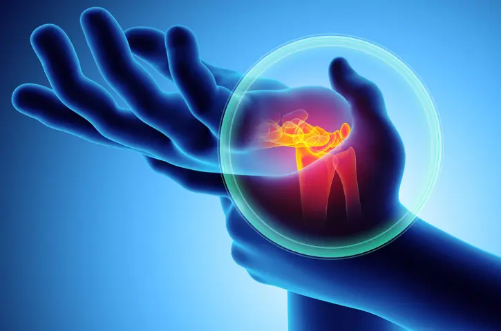 类风湿关节炎治疗 误区 千万别在犯了 哔哩哔哩