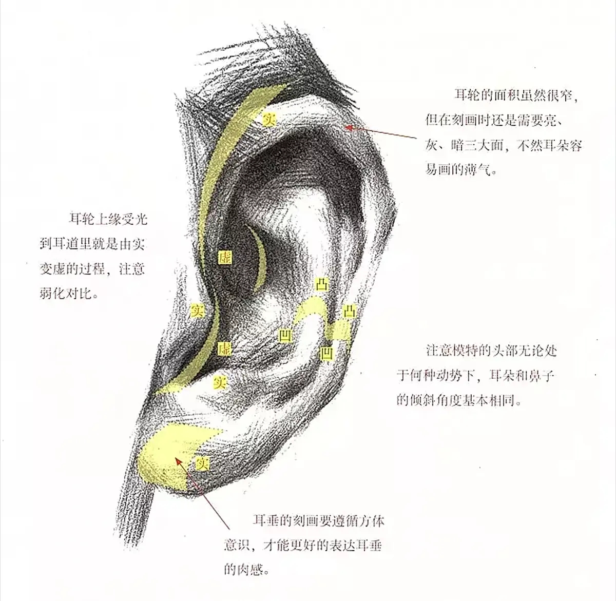 【案例分析】耳再造直埋法术后一年真实反馈，和正常耳朵几乎一样 - 知乎