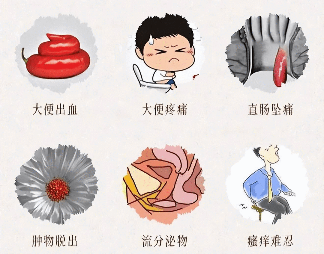 痔疮外痔肉球是什么原因引起的?用这几个方法,消除肉球很简单 - 哔哩哔哩