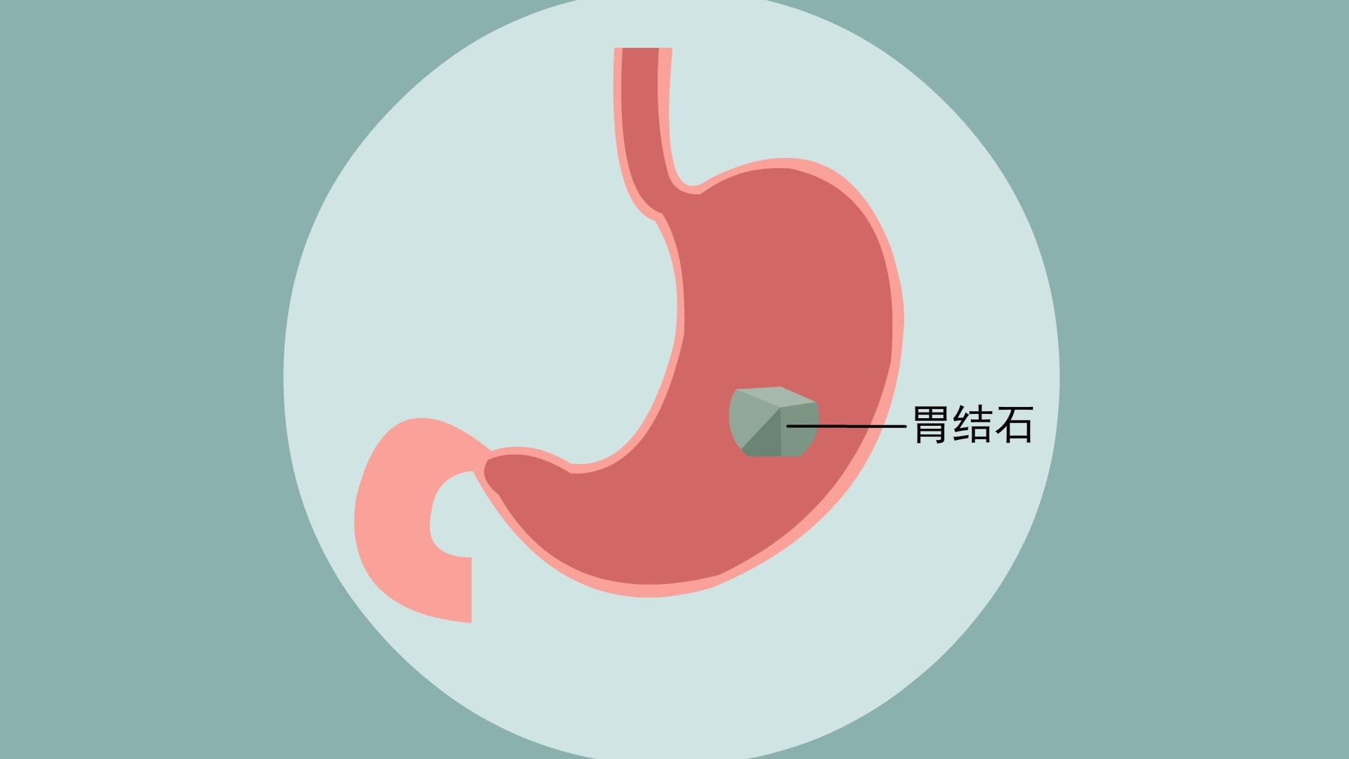 消化科博士教你：3分钟看懂胃镜报告！__中国医疗