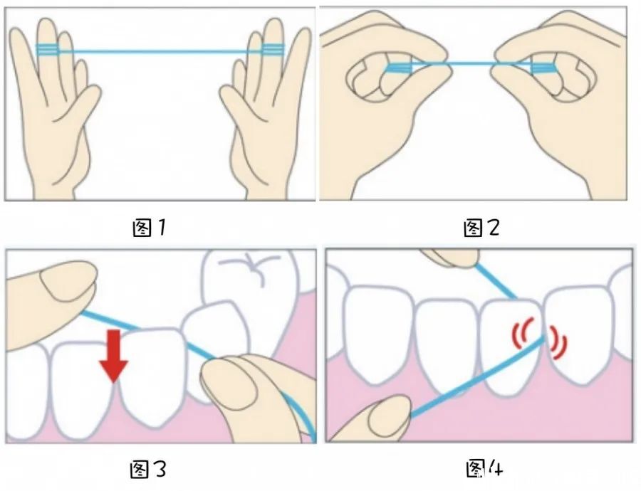 【科普】"口腔卫生小课堂"——"如何正确使用牙线?