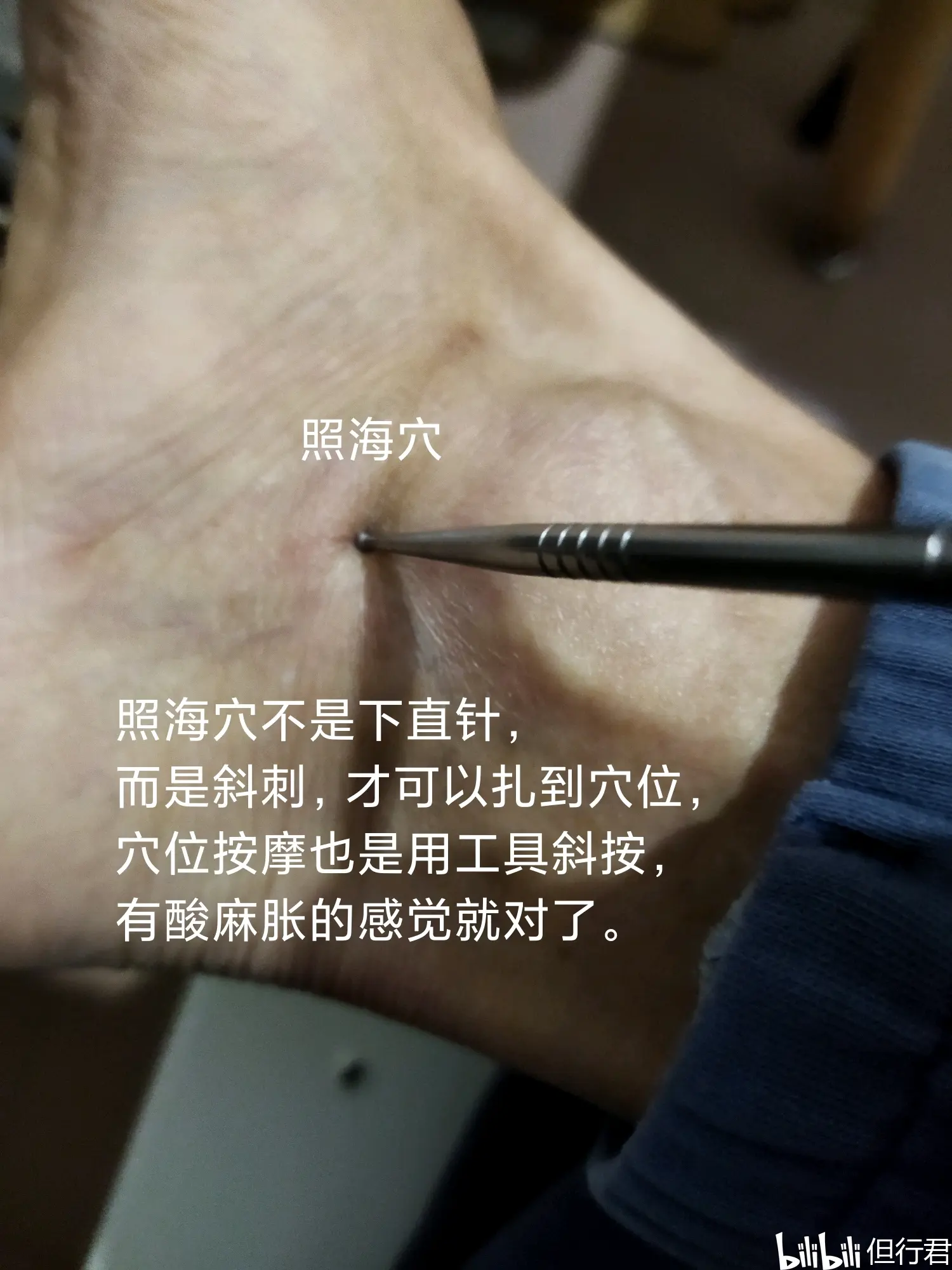 支沟 照海,便秘立竿见影,倪师诚不欺我! - 哔哩哔哩