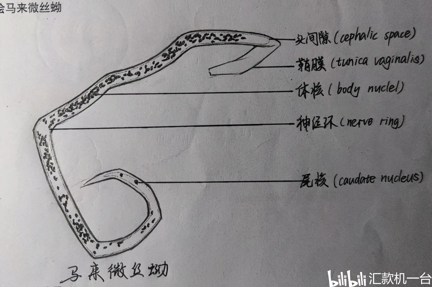 注意两种蛔虫卵的区别,未受精的卵体窄长,卵壳薄,内容物不可见清楚卵