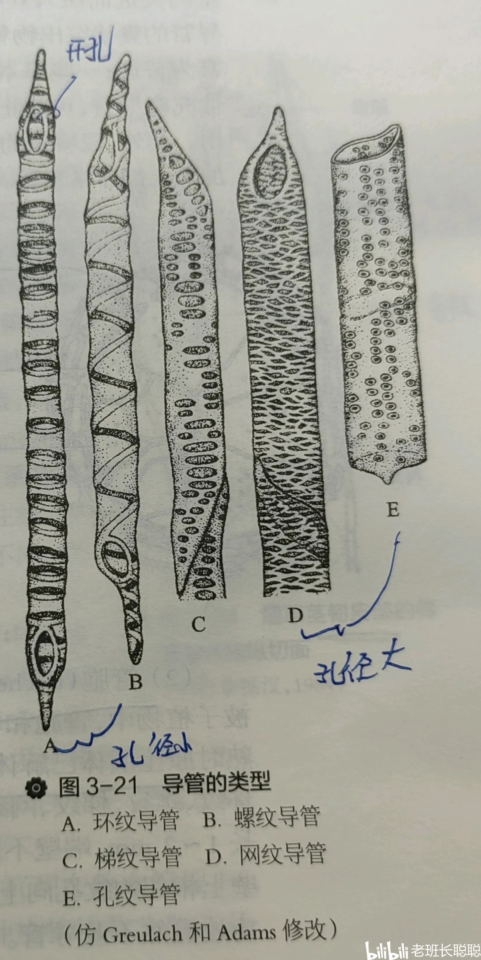 导管的手绘图图片