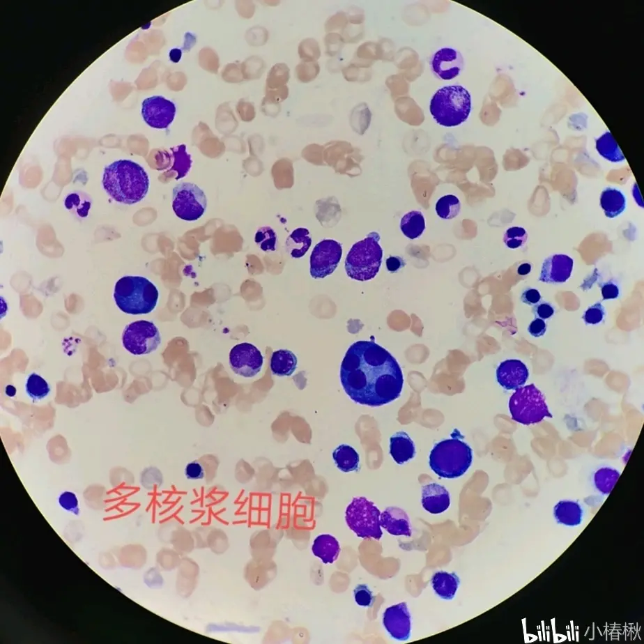人体骨髓细胞形态学 哔哩哔哩