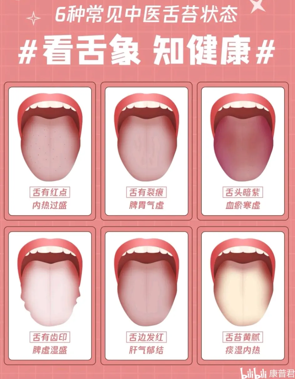 一张图让你简单看懂中医舌诊 哔哩哔哩