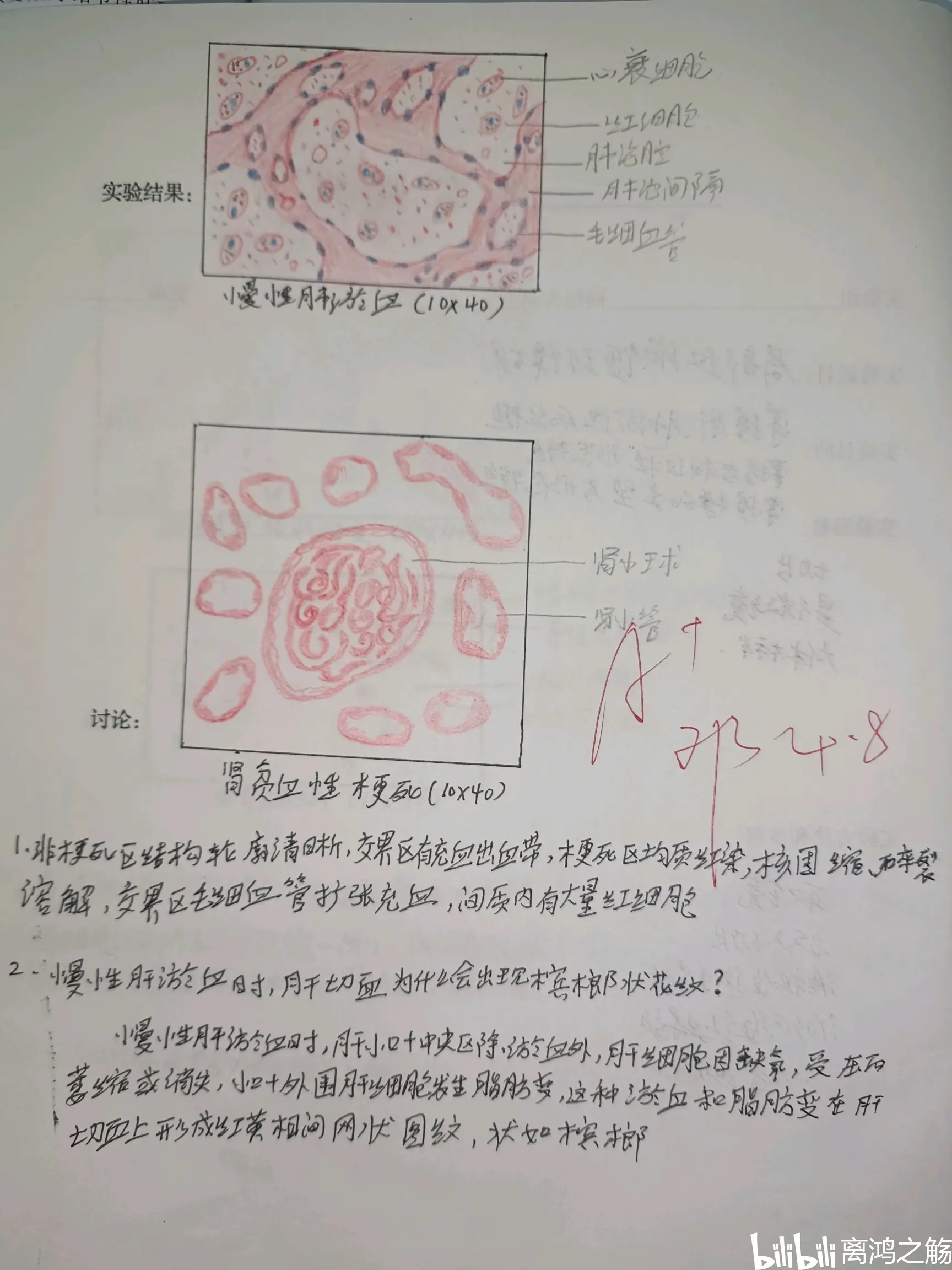 乙脑病理红蓝铅笔图图片