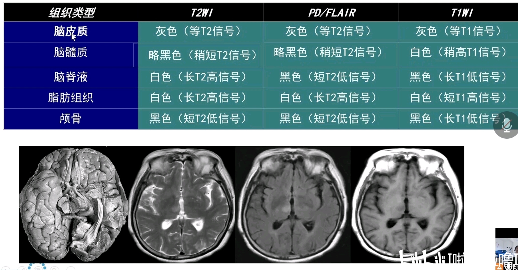 MRI常用序列的区分方法（啦啦啦自我总结鸭( ˃̶̤́ ꒳ ˂̶̤̀ )） - 哔哩哔哩