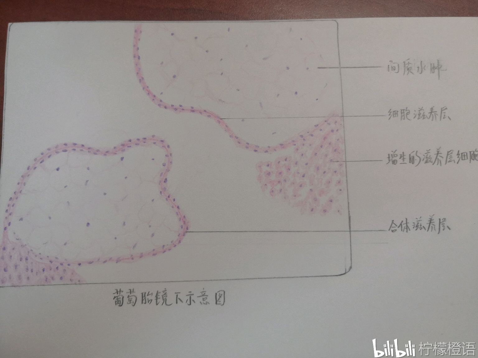 肥大细胞的手绘图图片