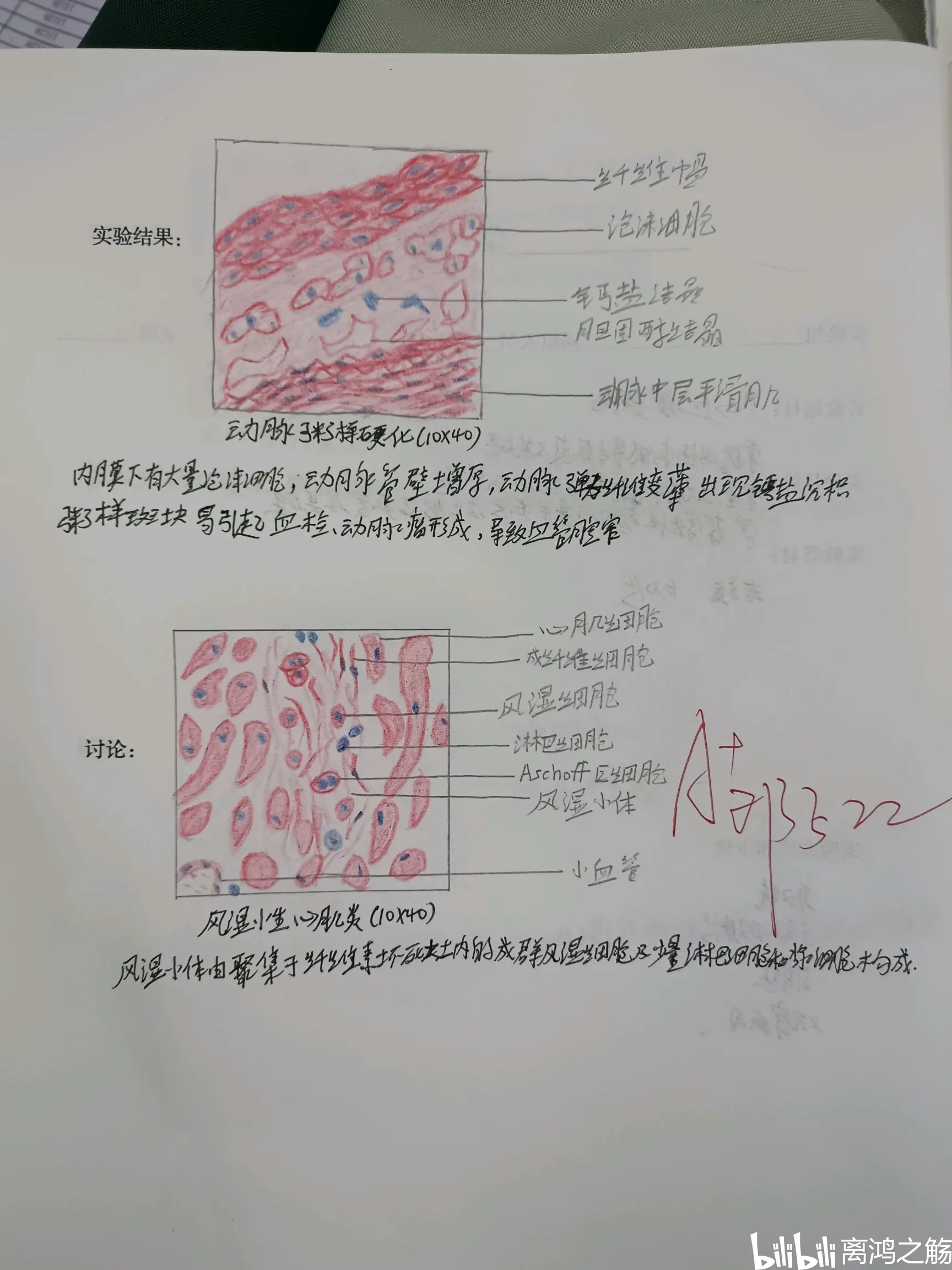 乙脑病理红蓝铅笔图图片