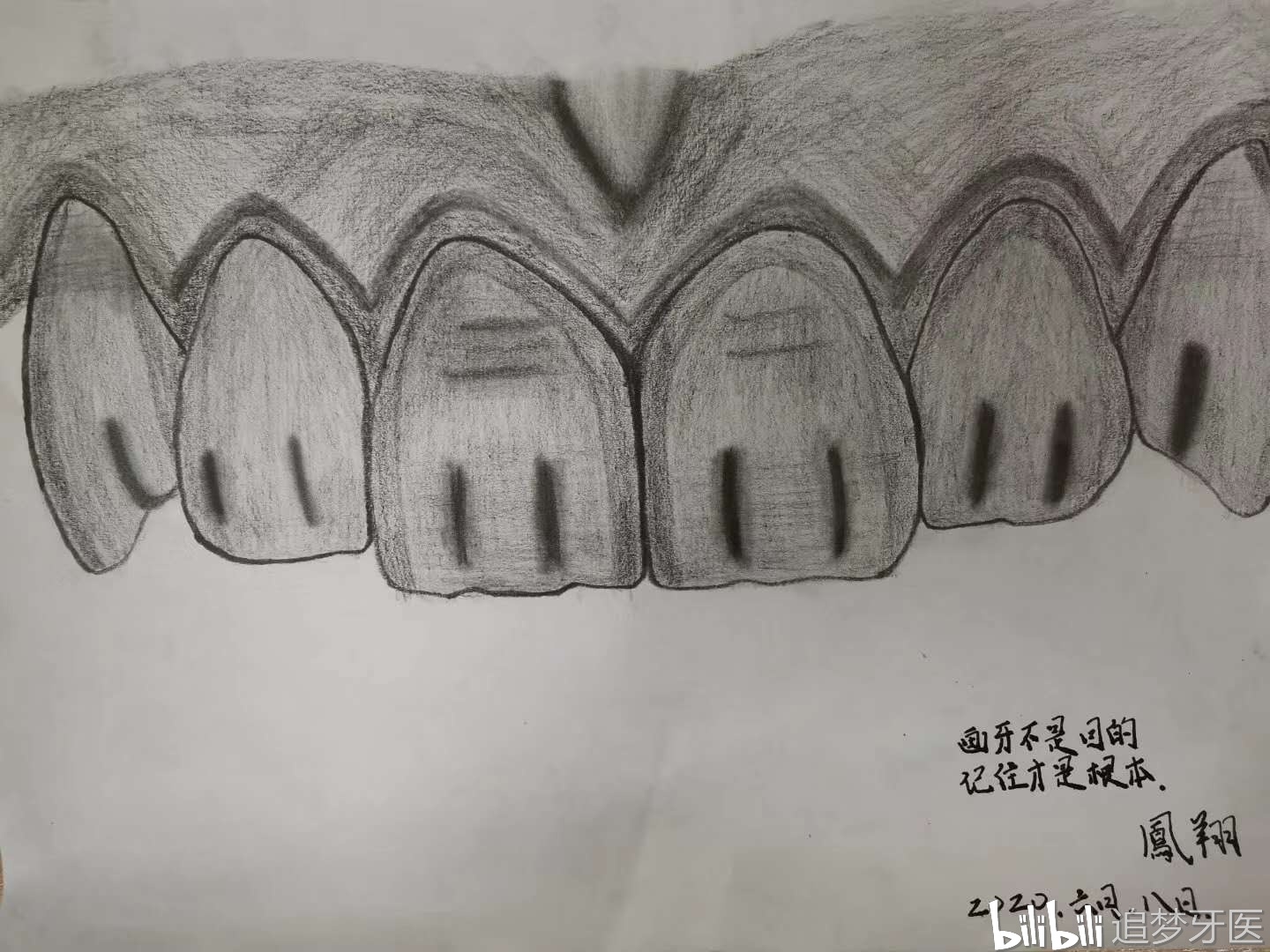 兴趣 绘画 画牙drawing teeth