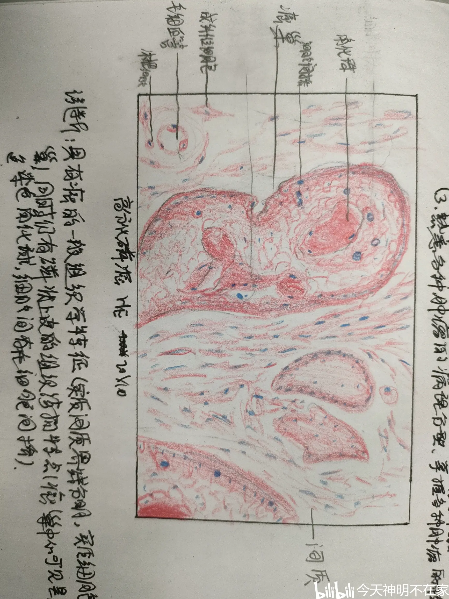 病理实验阑尾炎手绘图图片