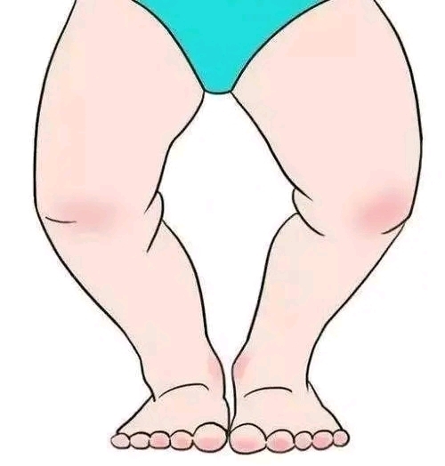 为什么跷二郎腿会惹病上身?