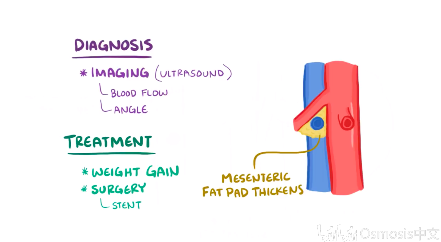【Osmosis医学】肾胡桃夹综合征 Nutcracker Syndrome 哔哩哔哩