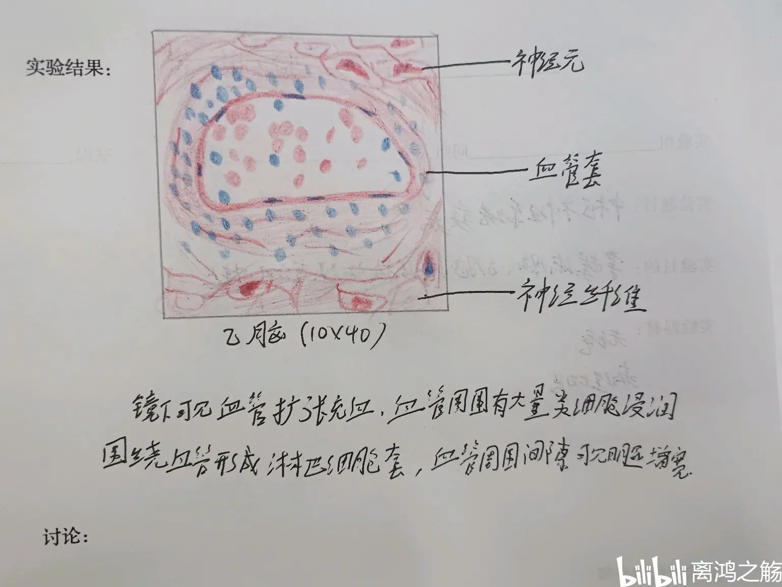 乙脑病理红蓝铅笔图图片