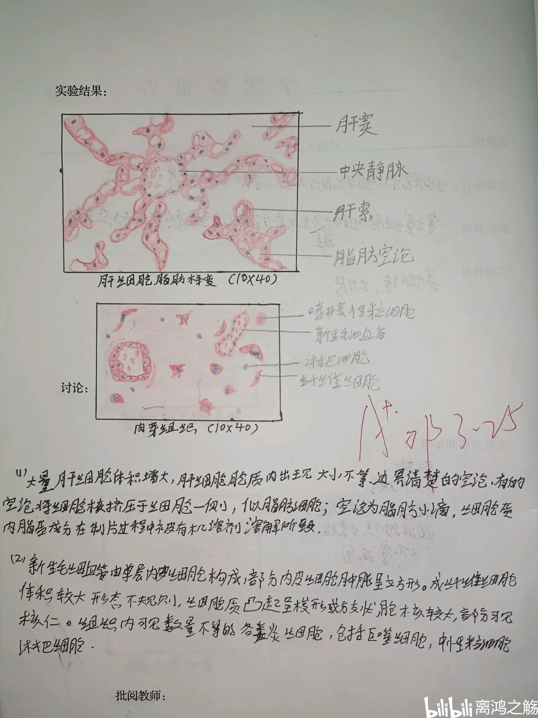 心肌萎缩图片手绘图图片