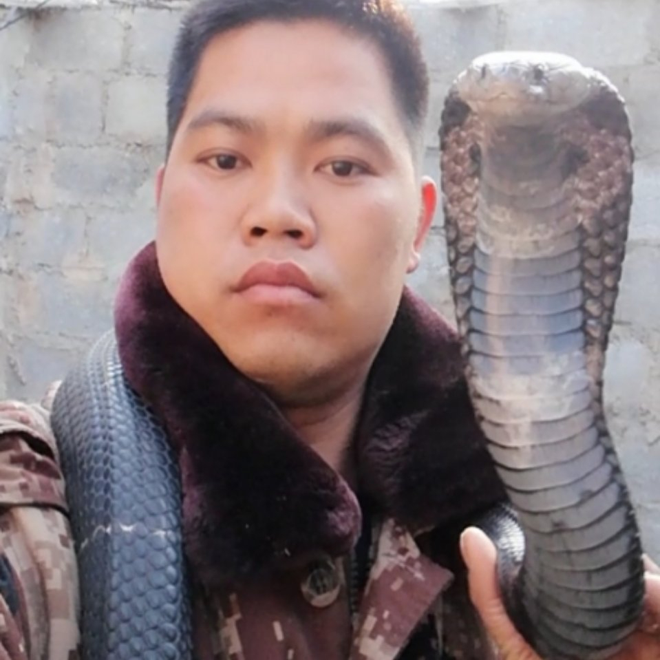 小蛇哥:被眼镜蛇咬后的急救,正确的处理方法,这是真的被咬了!