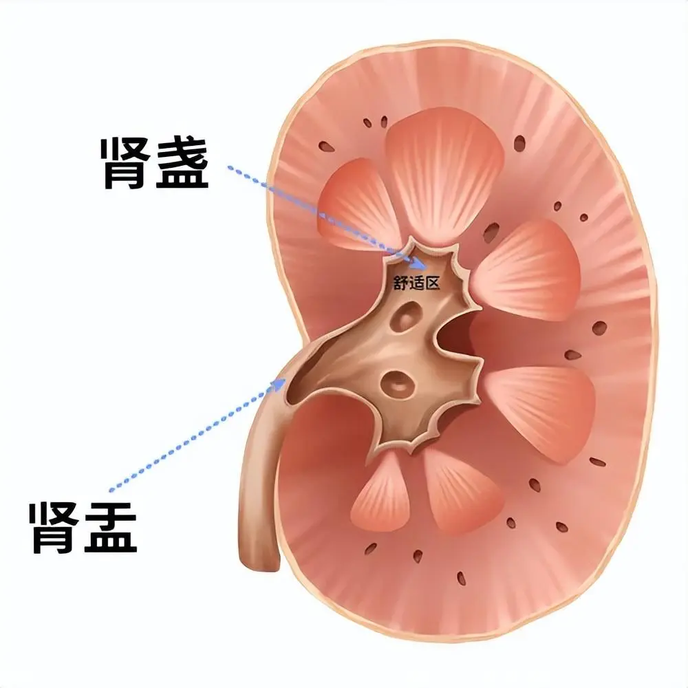 成都泌尿结石知识分享:不同位置的泌尿结石发作到底有多痛?