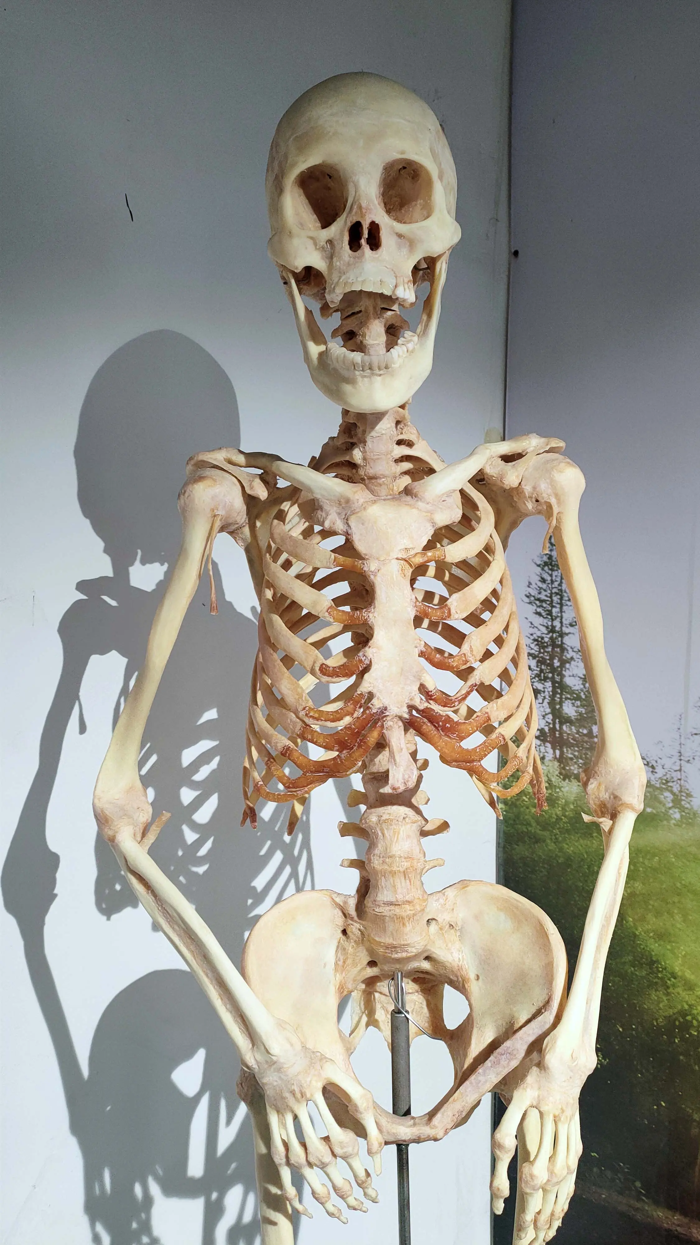 人类的26块椎骨和腰椎关节