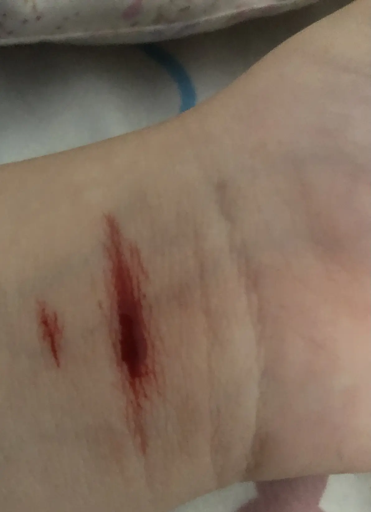 了,这是那段时间割的比较平凡,为了让自己不要再经常自残就想了个方法