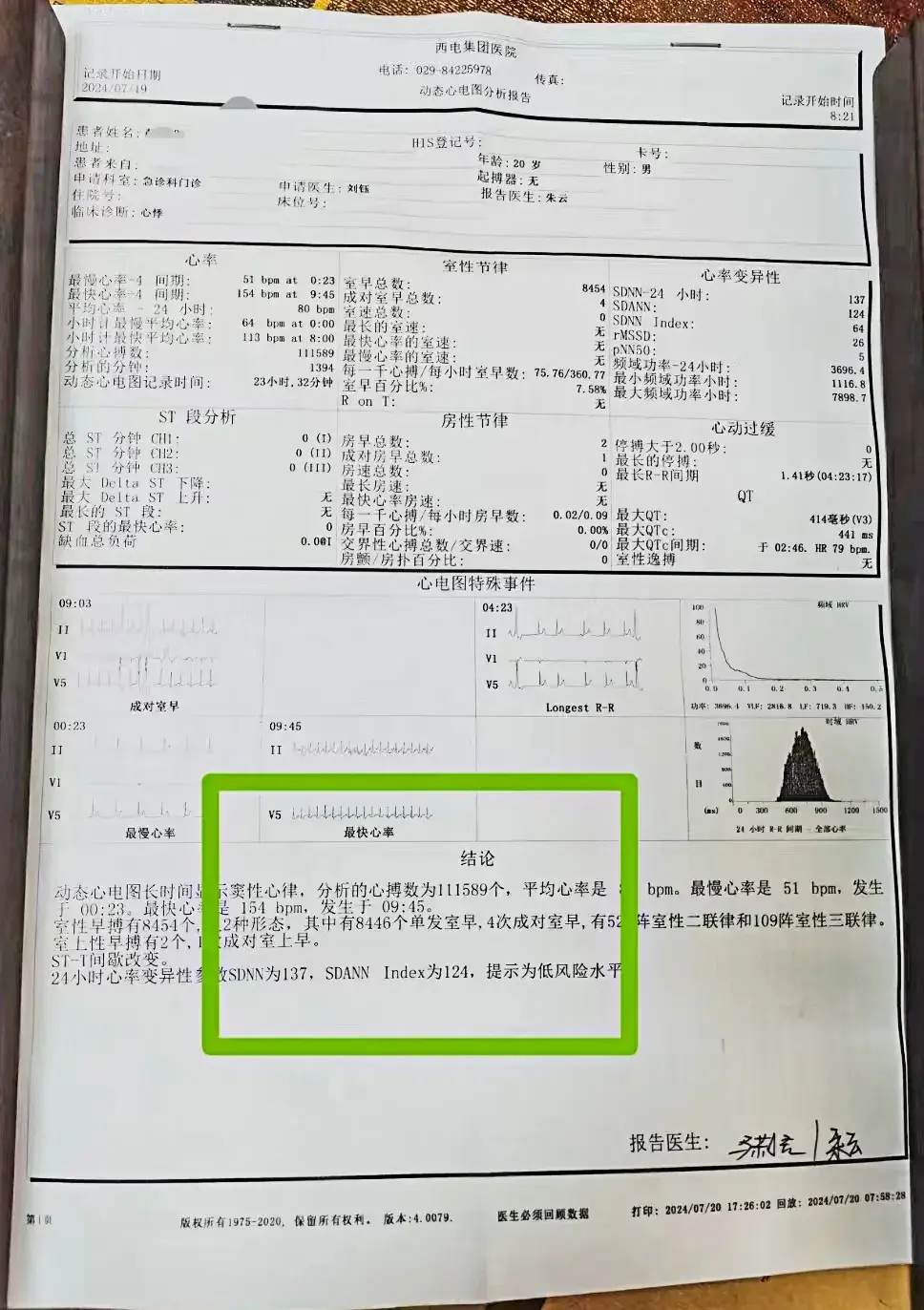 中医治疗严重心律不齐疗效显著