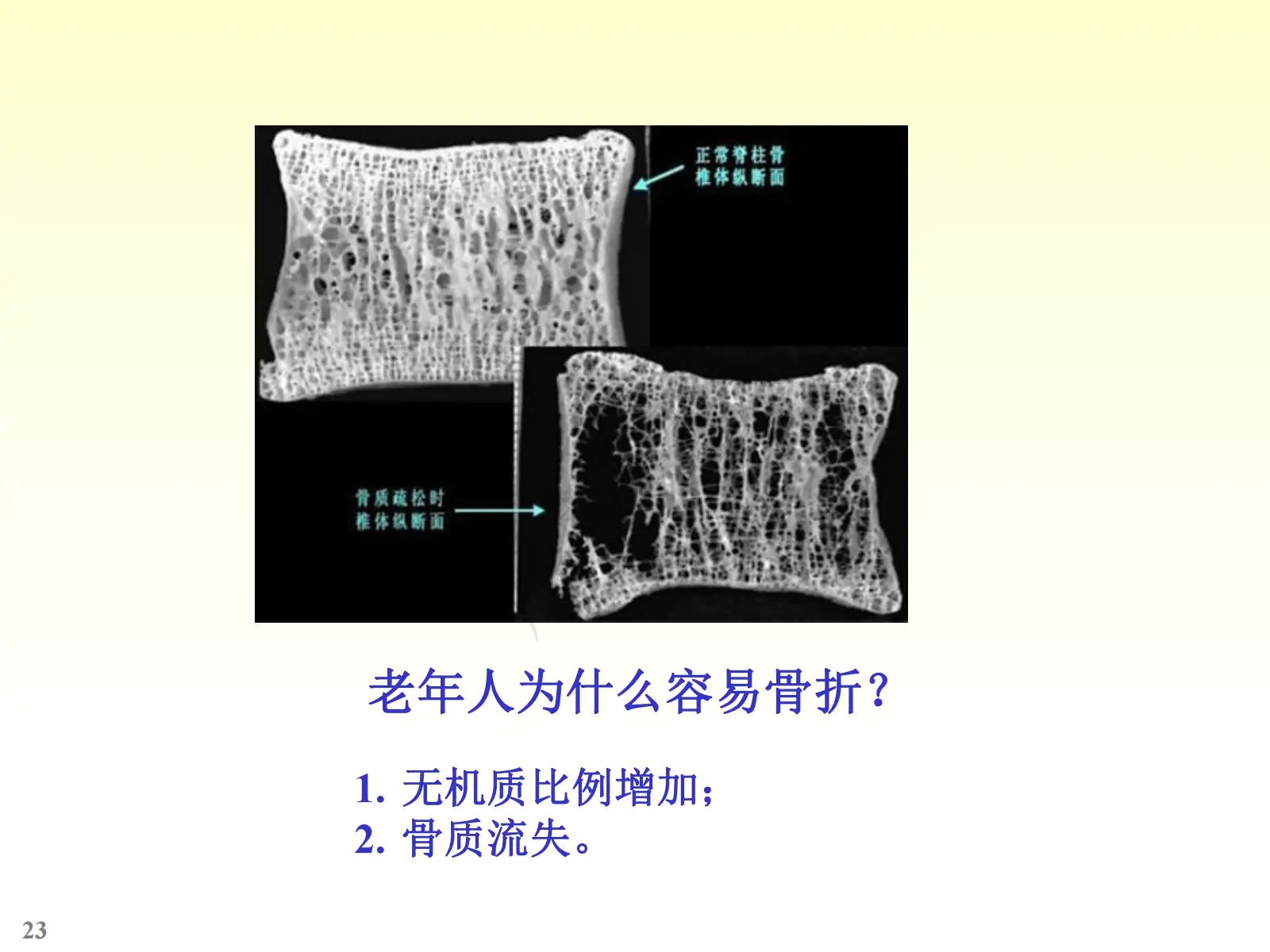 骨学ppt图片