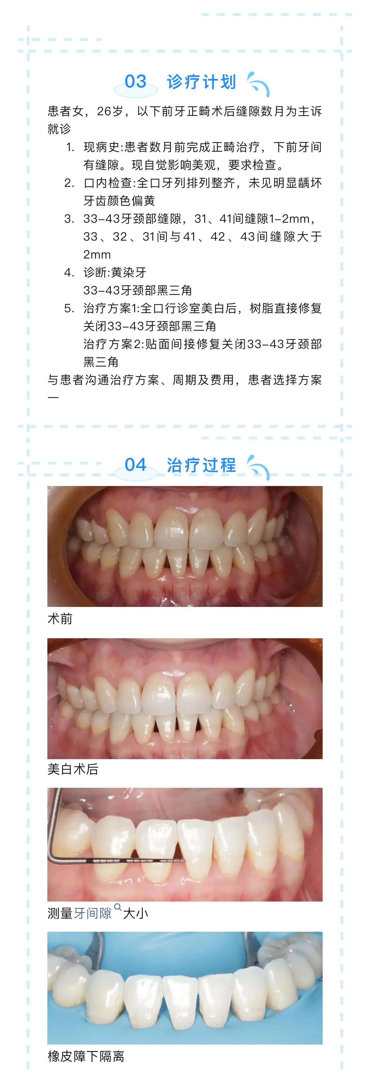 黑三角牙齿案例图片