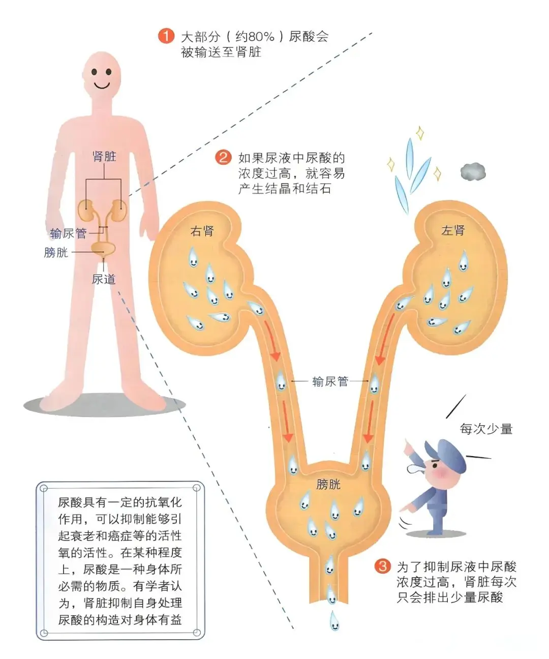 高尿酸患者提高代谢能力的四种方法痛风专家黄川云告诉你