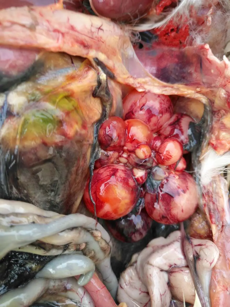 鹅卵黄性腹膜炎详解大全