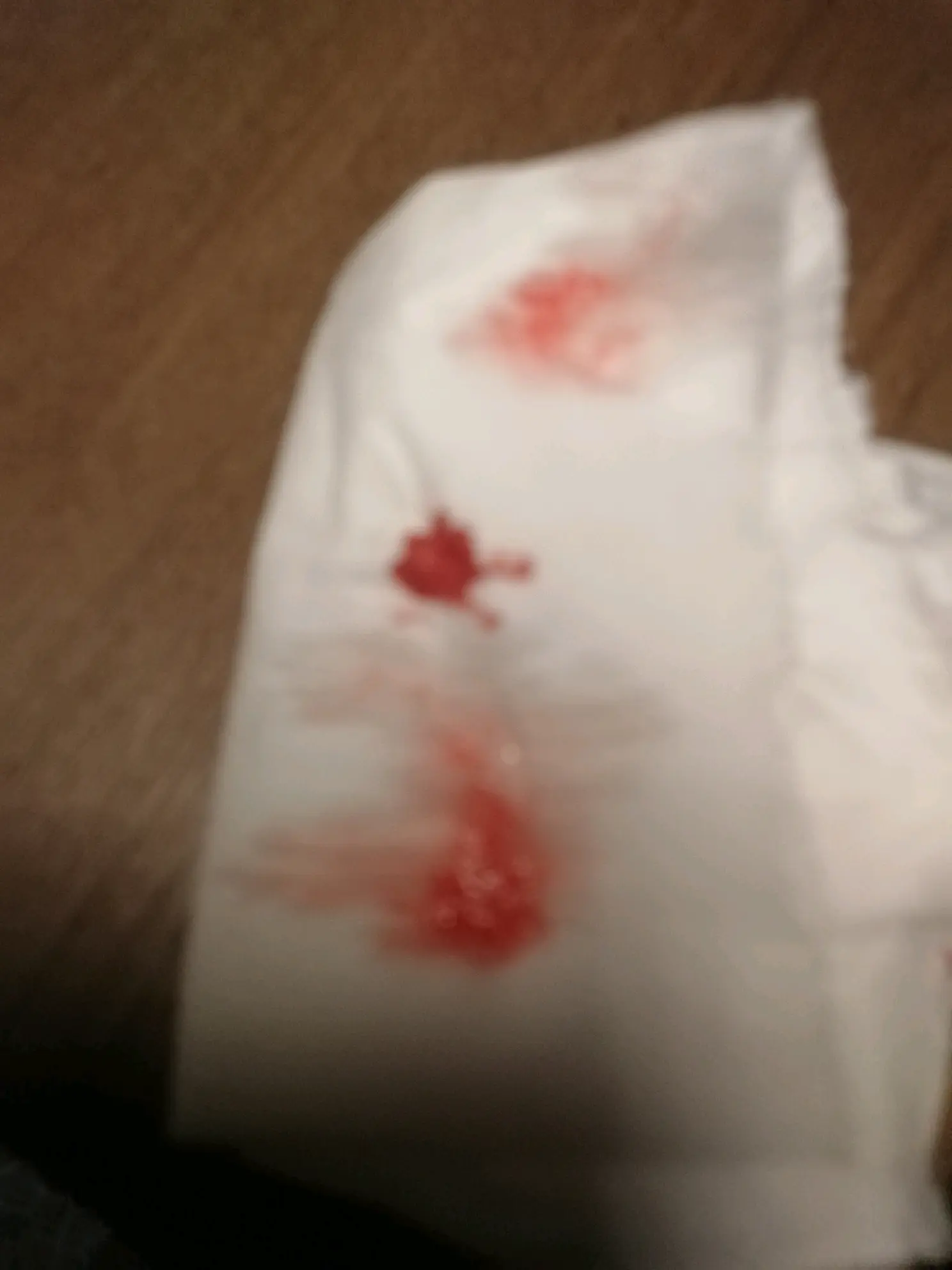 大半夜的咳出来血了,是不是要亖了