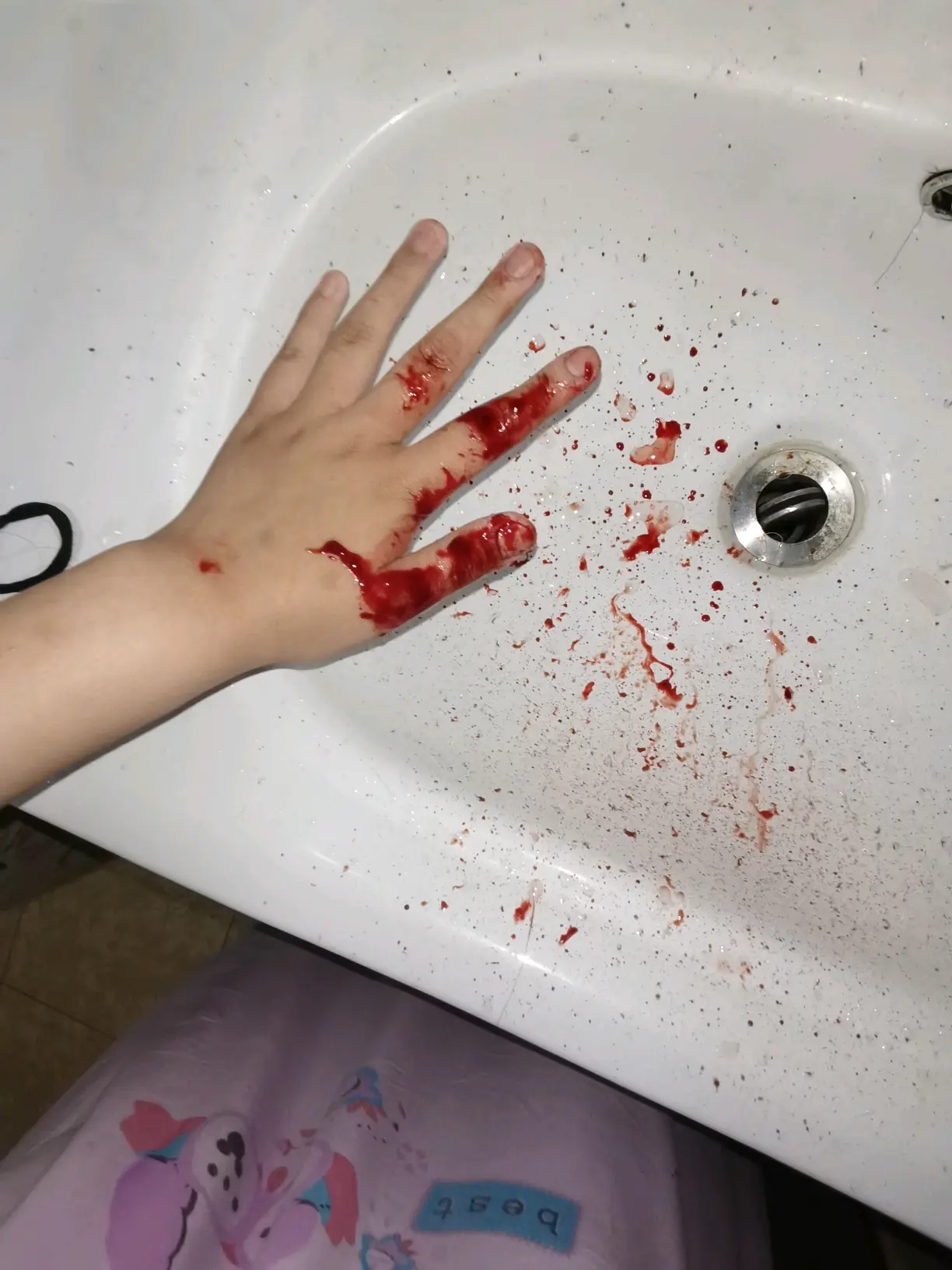 半夜擤鼻涕把鼻血擤出来了望周知