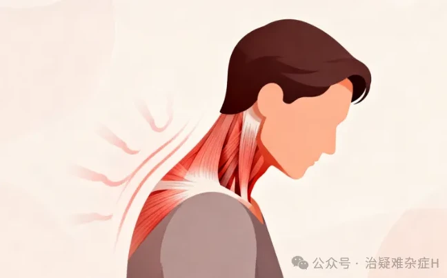 一文读懂痉挛性斜颈:病因、症状、治疗手段一次说清 - 哔哩哔哩