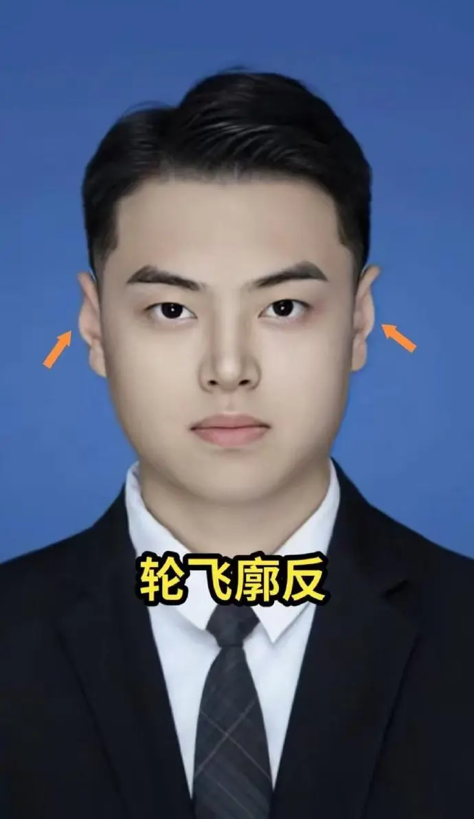 反骨耳的男人,千万别得意忘形!