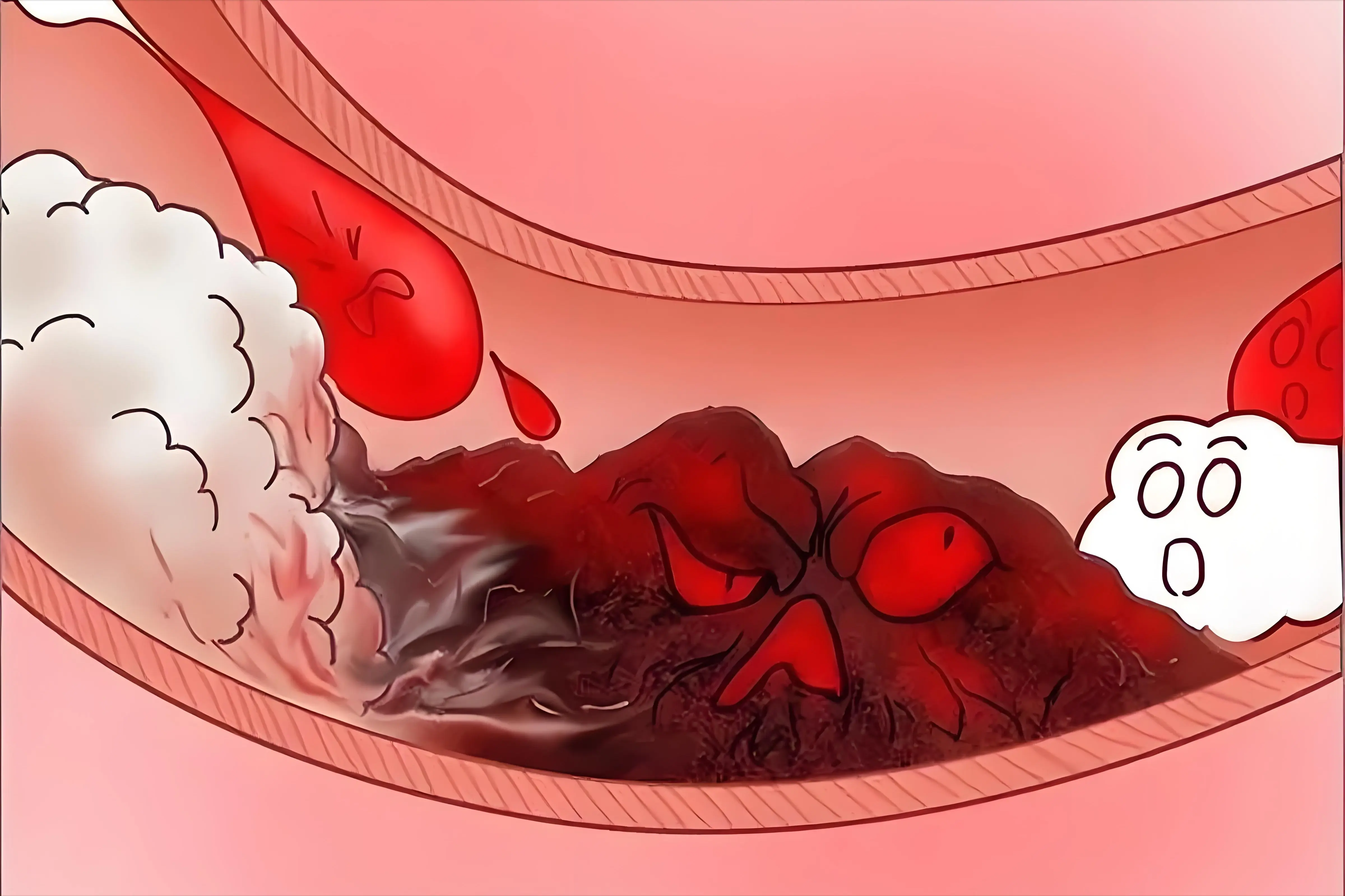 还真有,这个红花逍遥颗粒