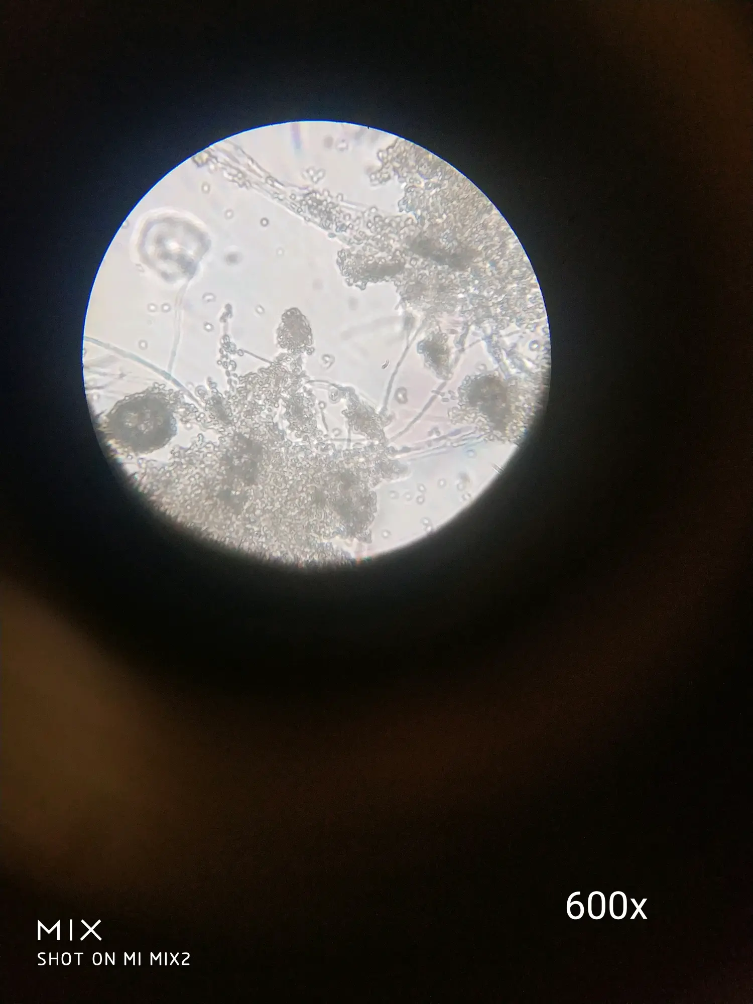 青霉菌菌落图片专辑