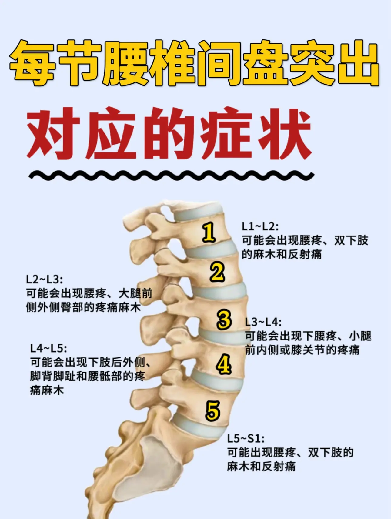 每节腰椎间盘突出对应的症状