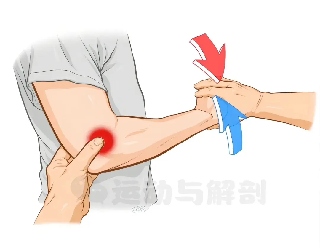 什么是网球肘,该如何评估和治疗?