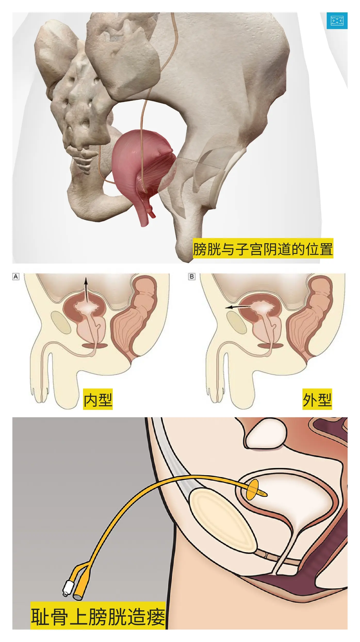 女性膀胱的位置图解图片