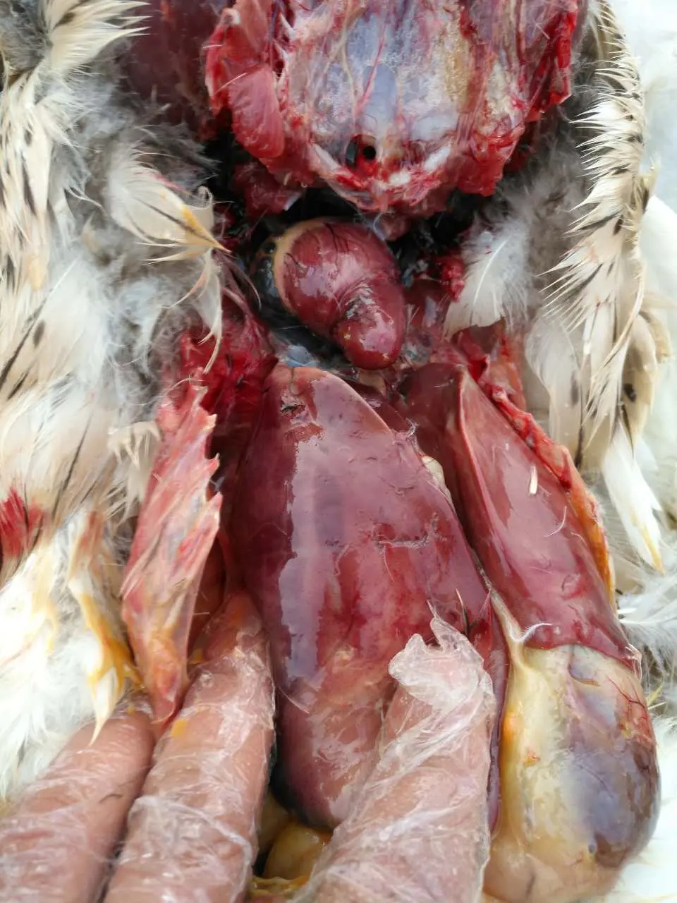 鹅卵黄性腹膜炎详解大全