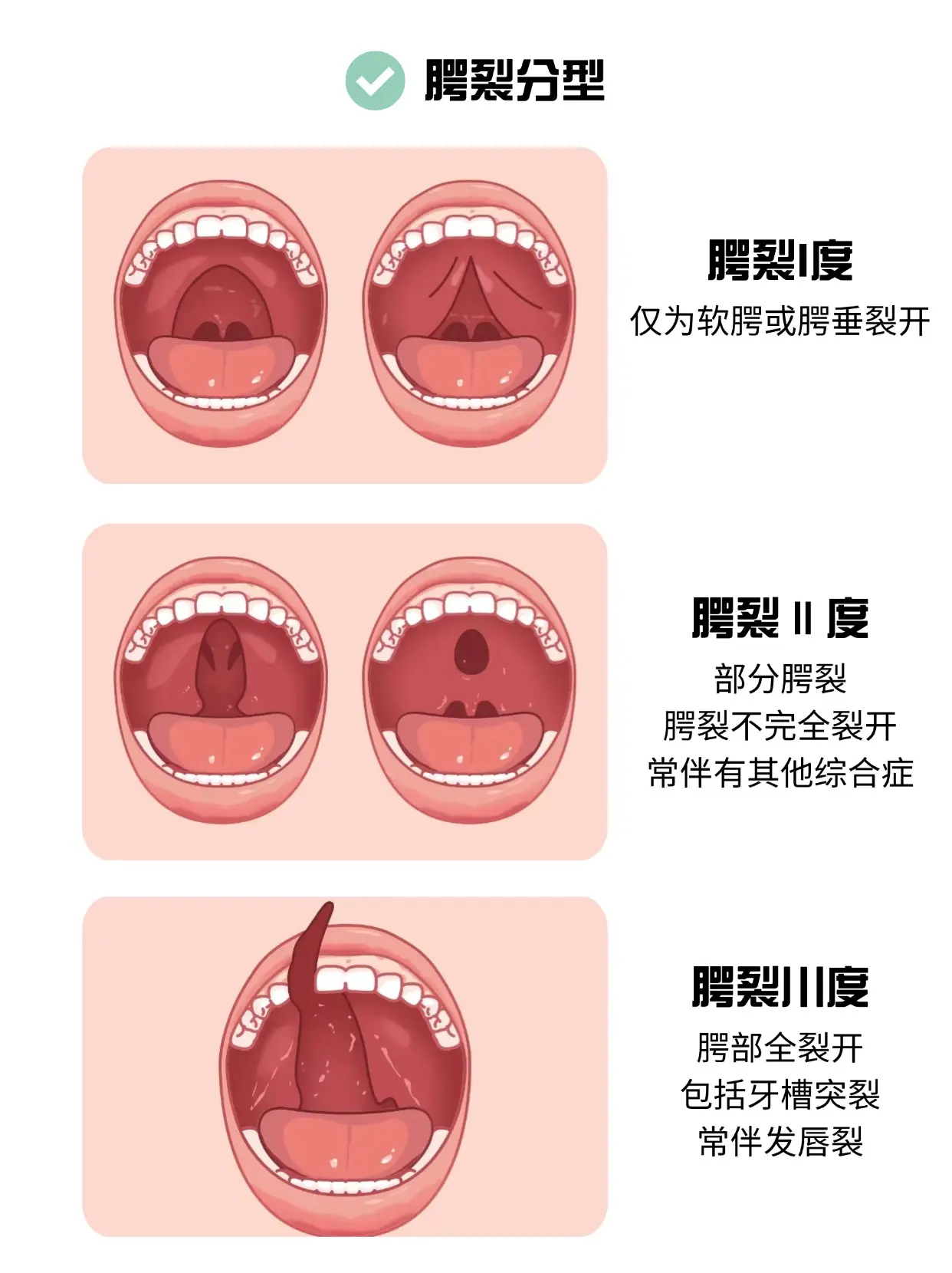 唇腭裂8mm图片