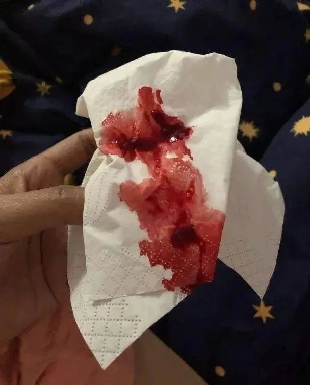 最近咳血有点厉害