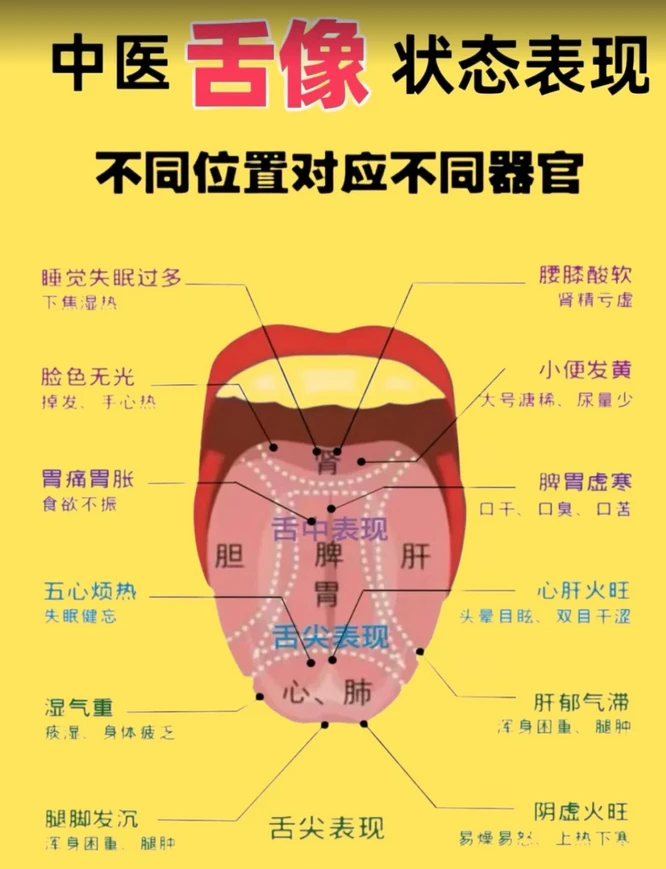 中医舌象 状态表现,齿痕舌、裂纹舌、草莓舌,你是哪一种? - 哔哩哔哩
