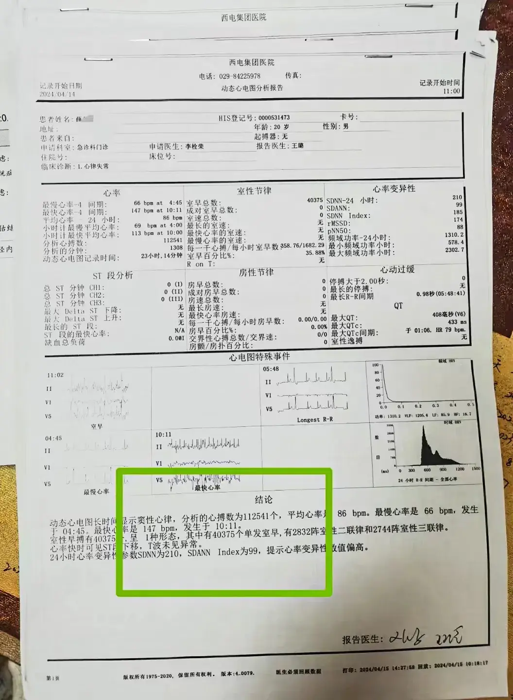 中医治疗严重心律不齐疗效显著