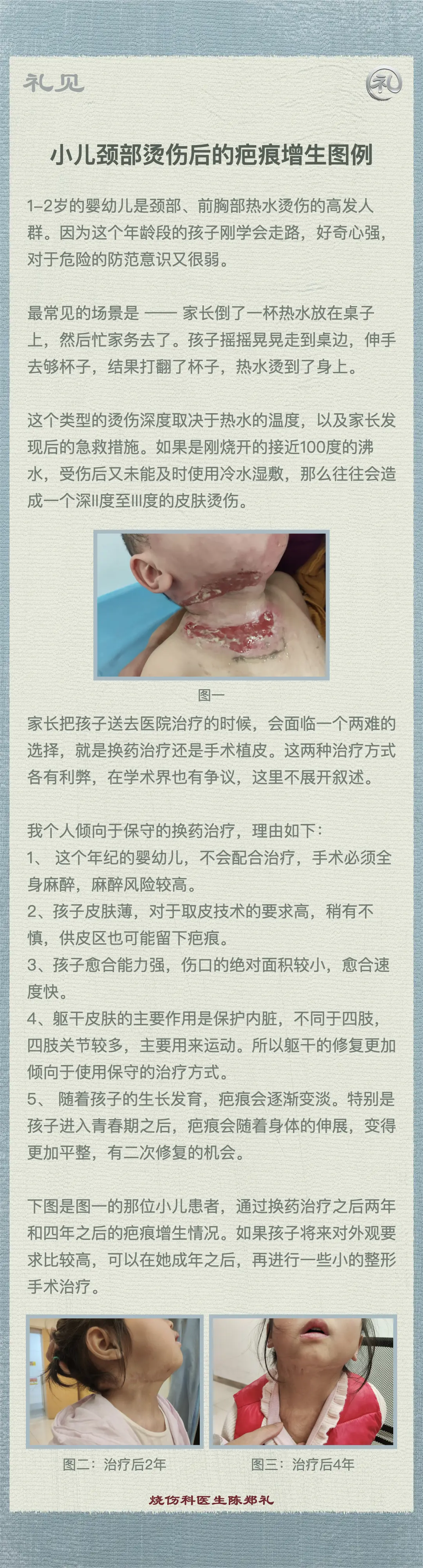 小儿颈部烫伤后的疤痕增生图例
